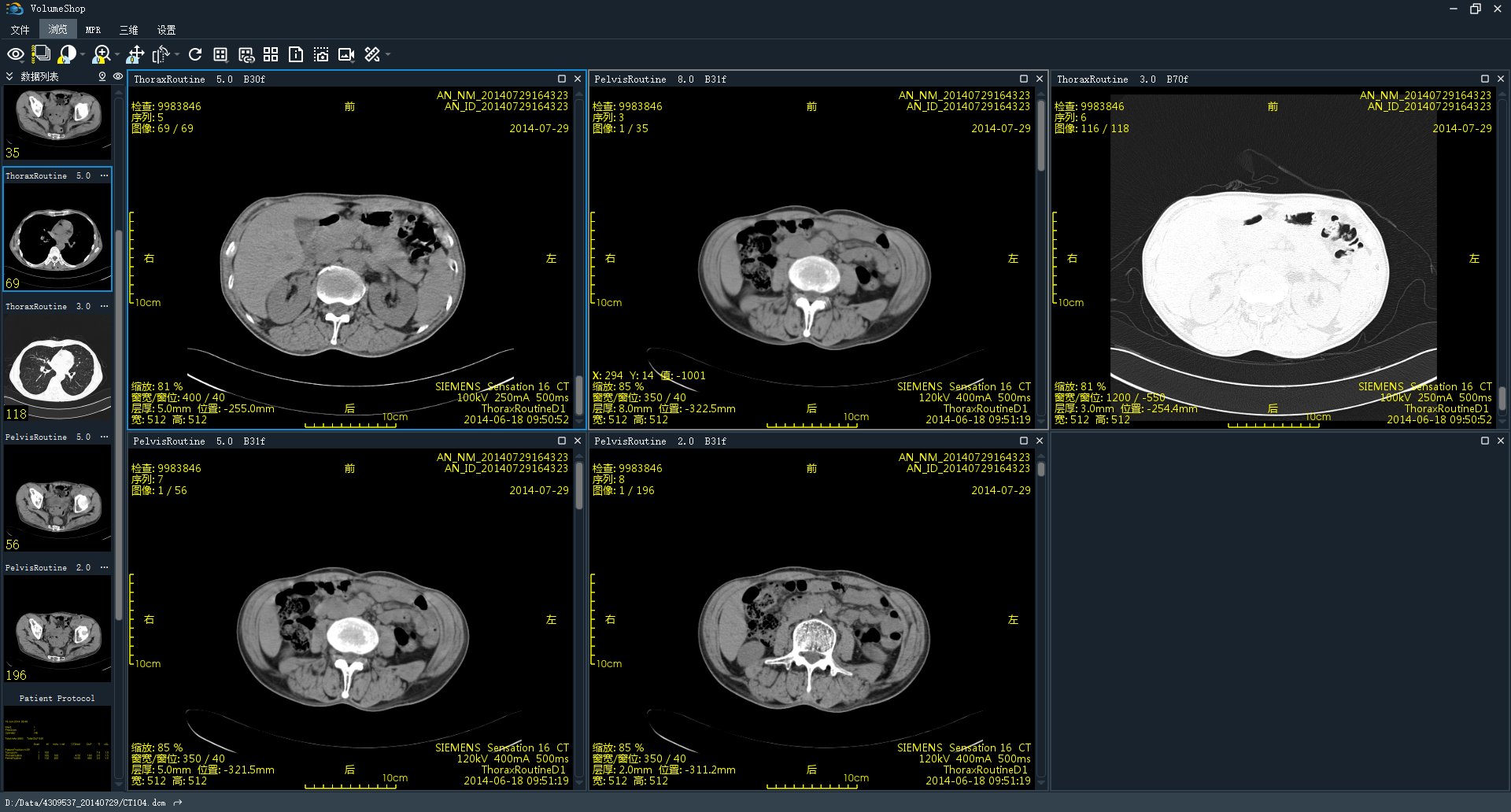 multiwindow